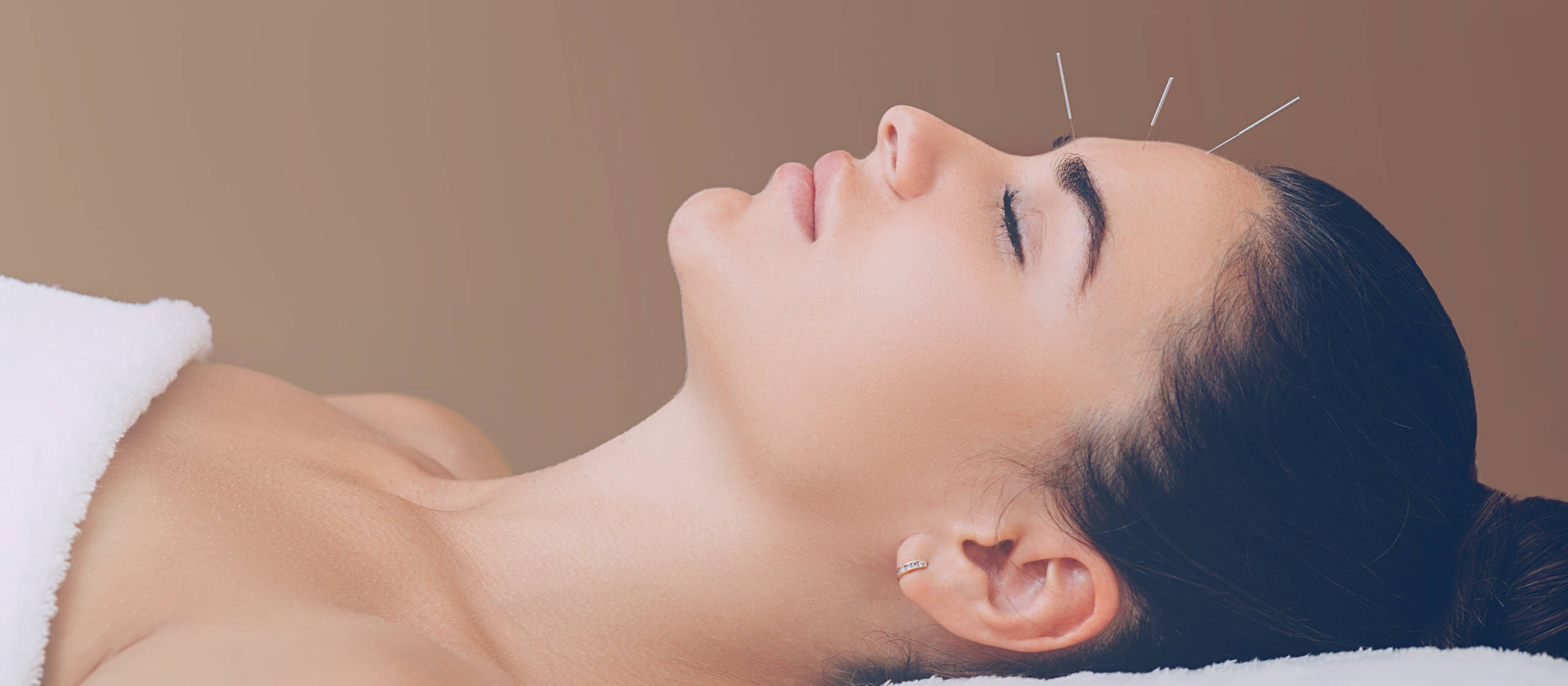 Aesthetic acupuncture