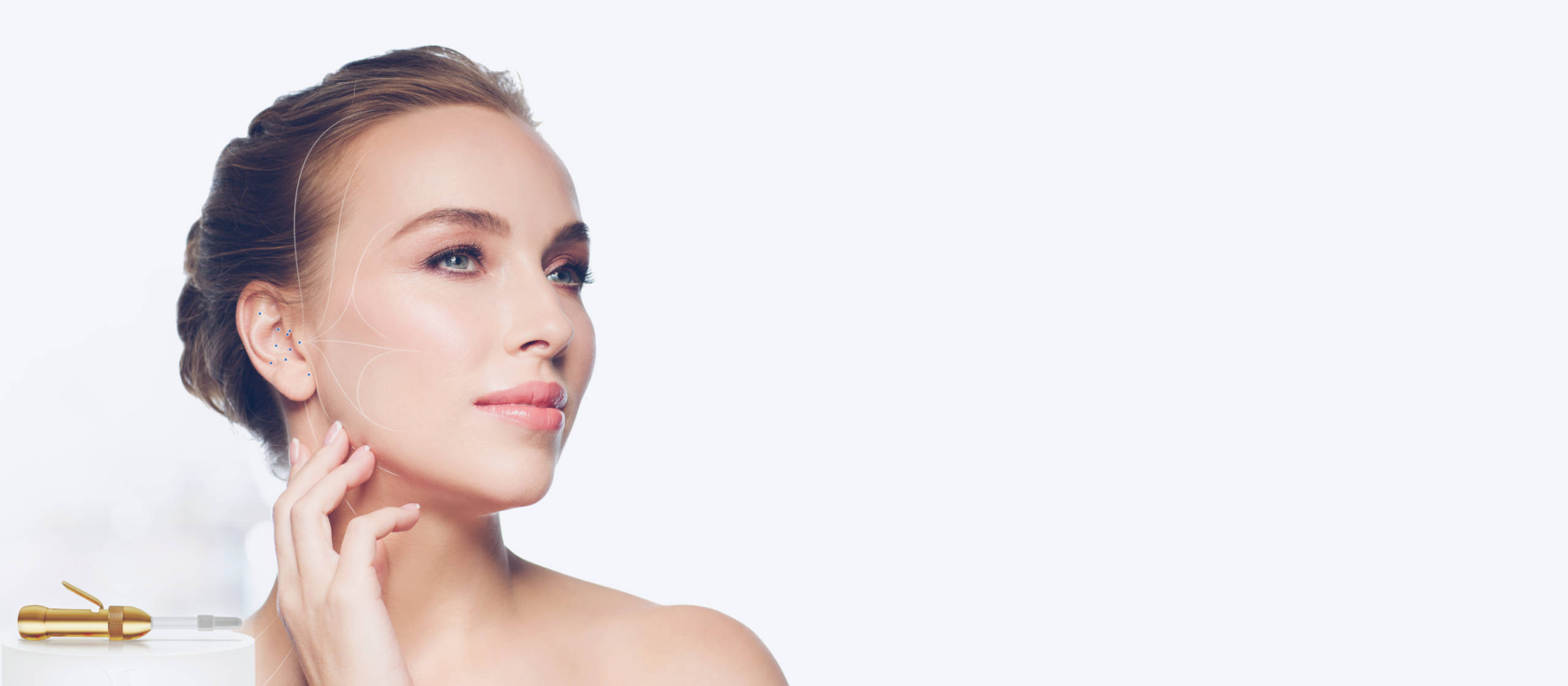 Cryo-auriculotherapy