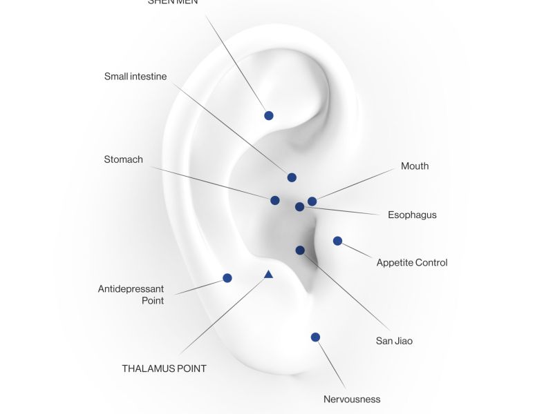 L'acupuncture par le froid, sans aiguilles 