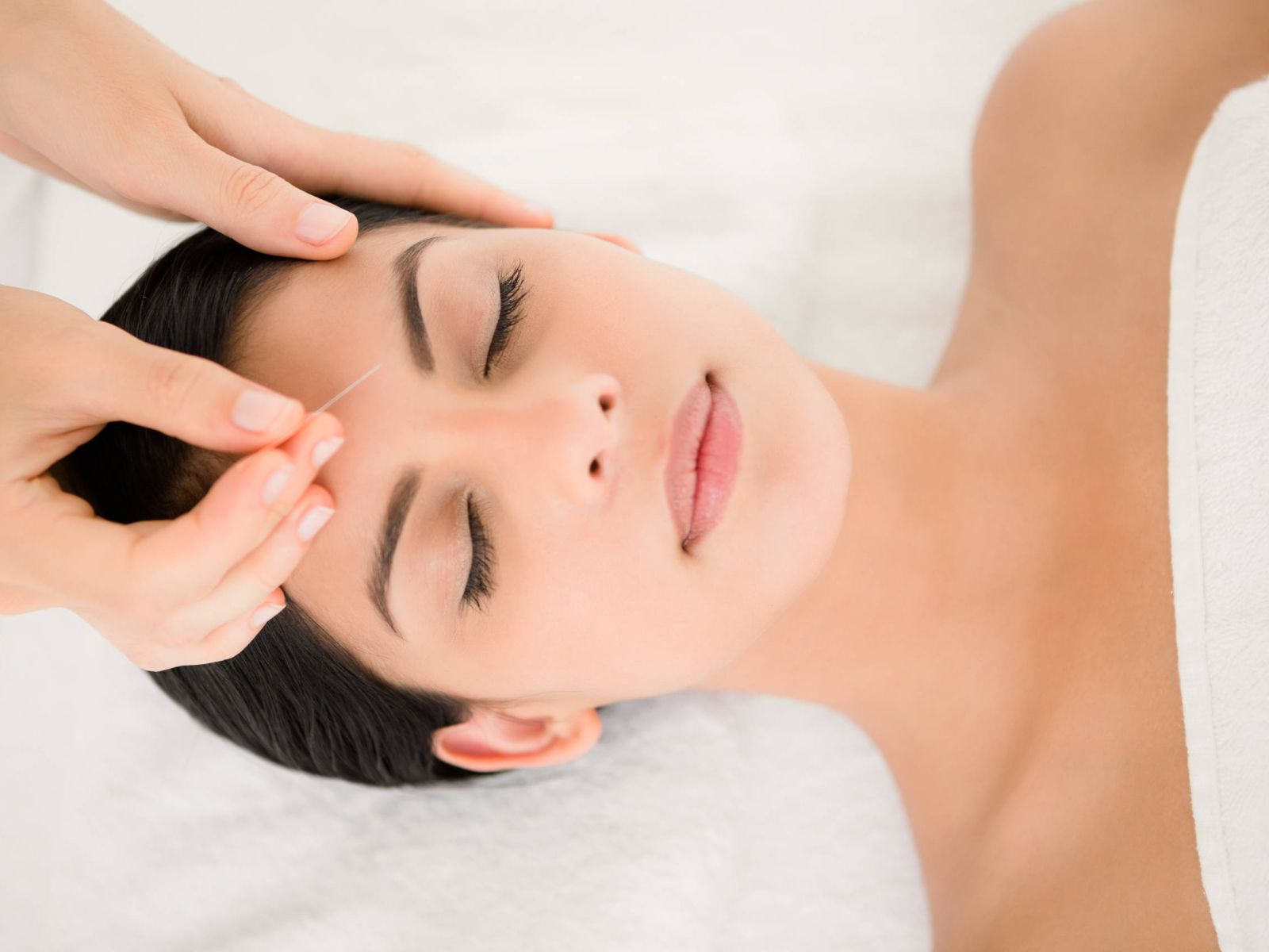 Aesthetic acupuncture of the face