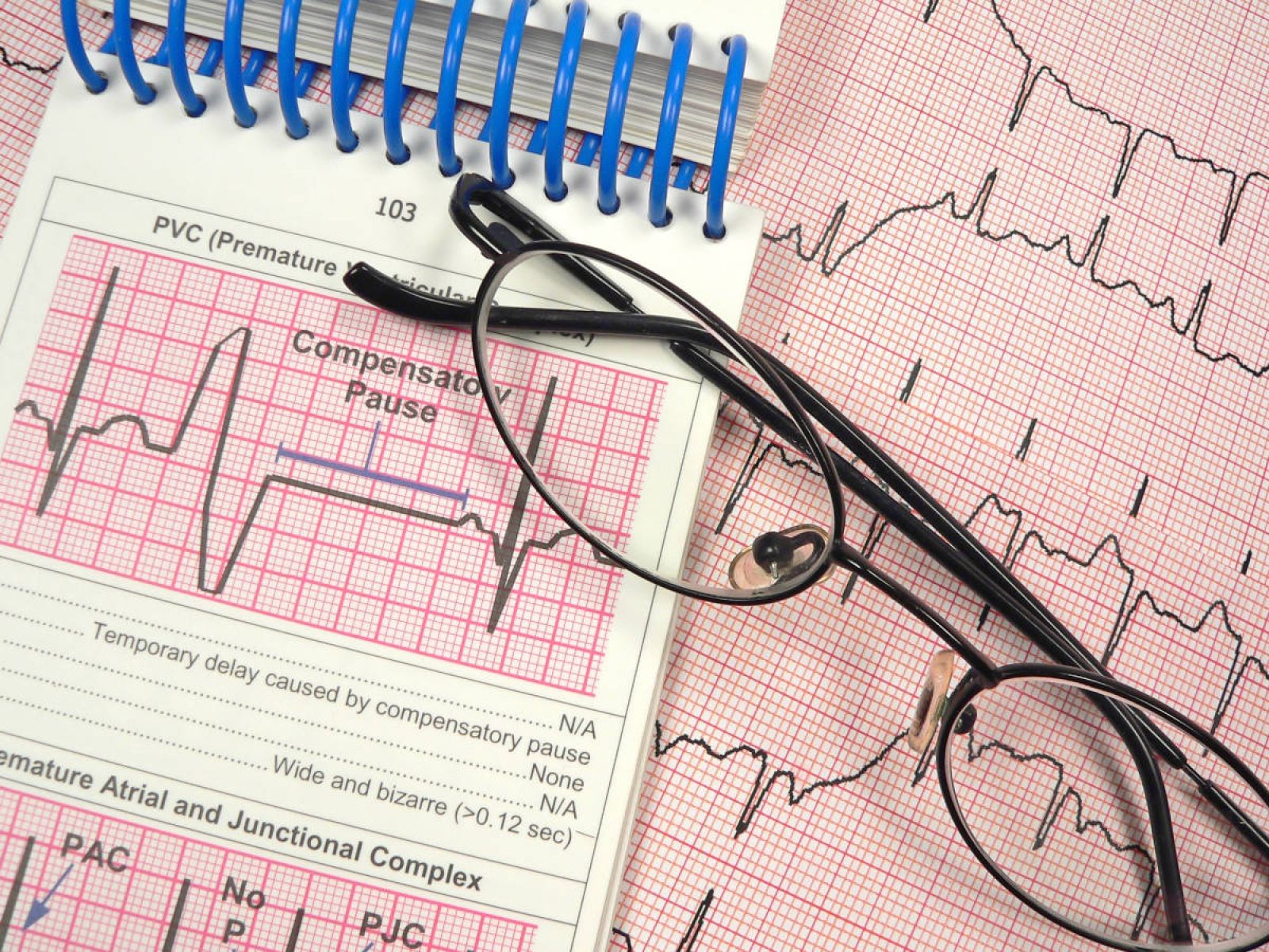 électrocardiogramme 