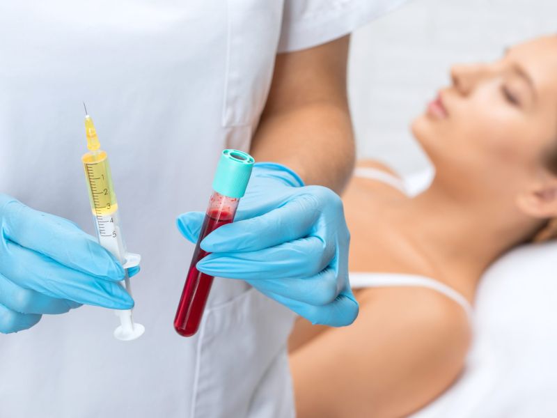 Le plasma extrait du sang sert aux injections anti-âge de PRP (Plasma Riche en Plaquettes)