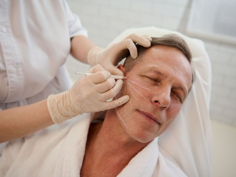 Design phase before filers