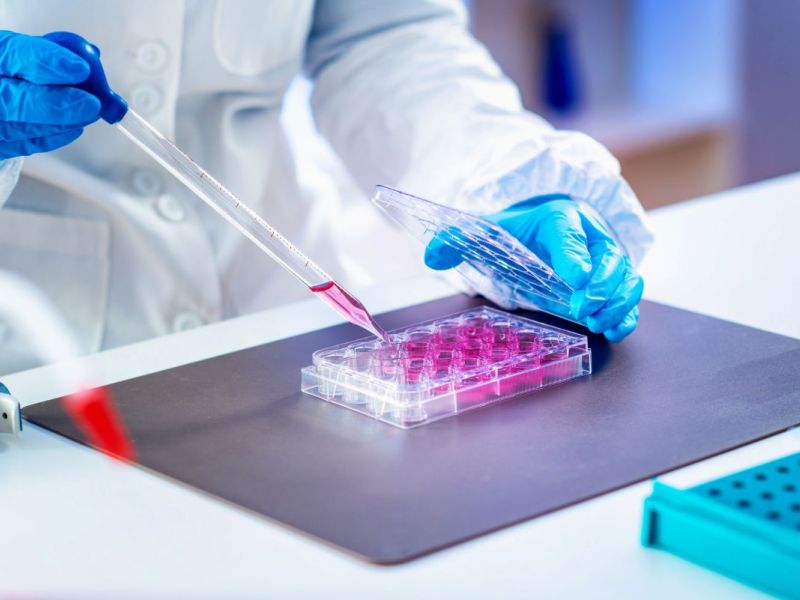 Stem cells are extracted from the harvested fat.