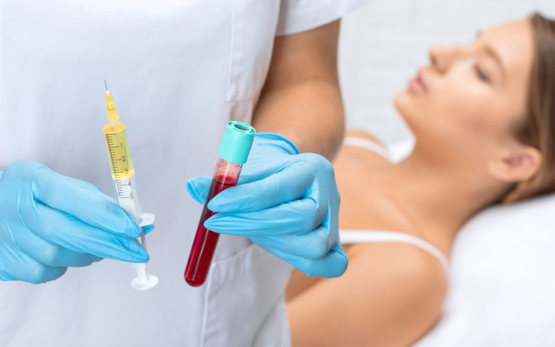 Plasma extracted from blood is used for PRP (Platelet Rich Plasma) anti-ageing injections.