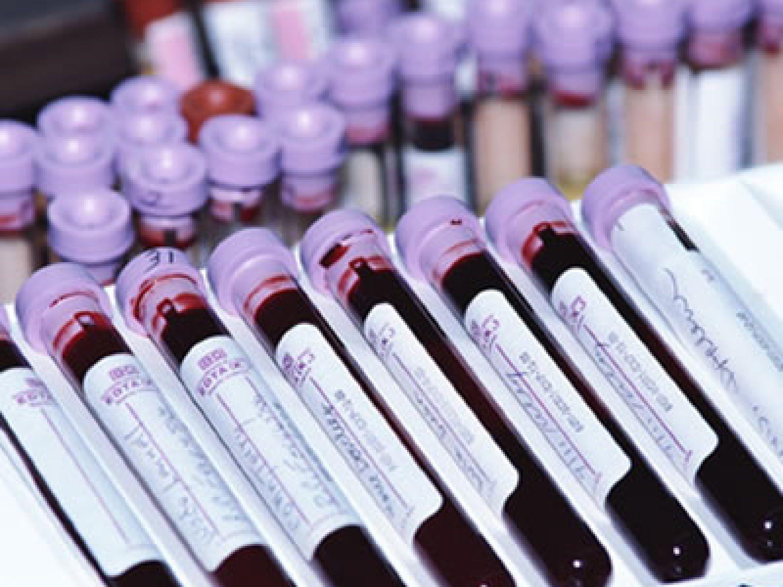 blood sample