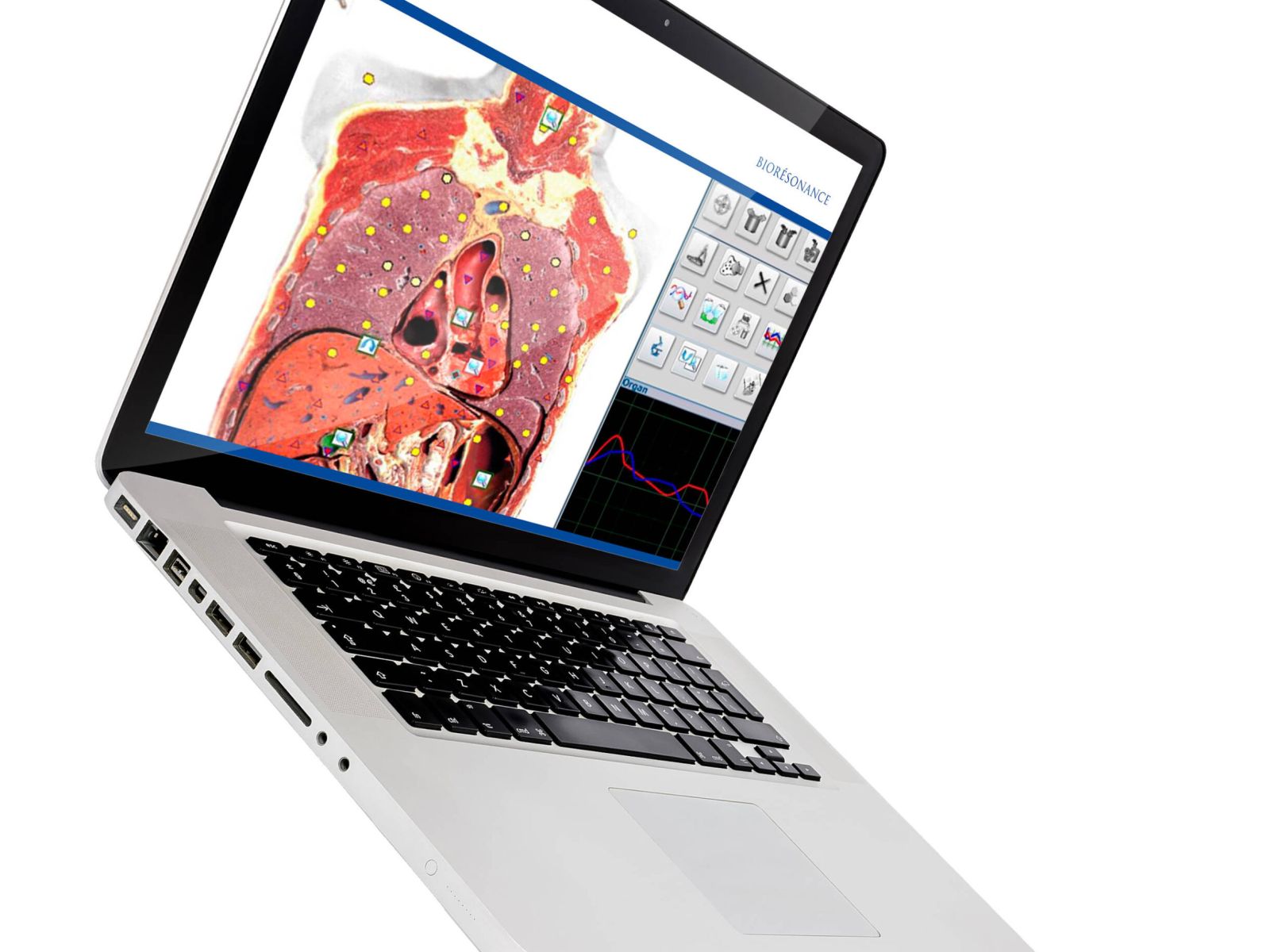 Bioresonance testing